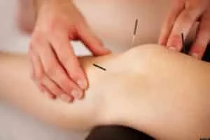 سوزن خشک یا نیدل فیزیوتراپی چیست