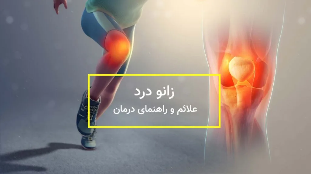 درمان زانو درد
