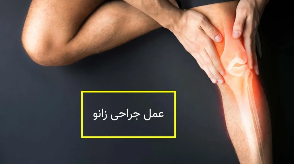 فیزیوتراپی بعد از جراحی زانو