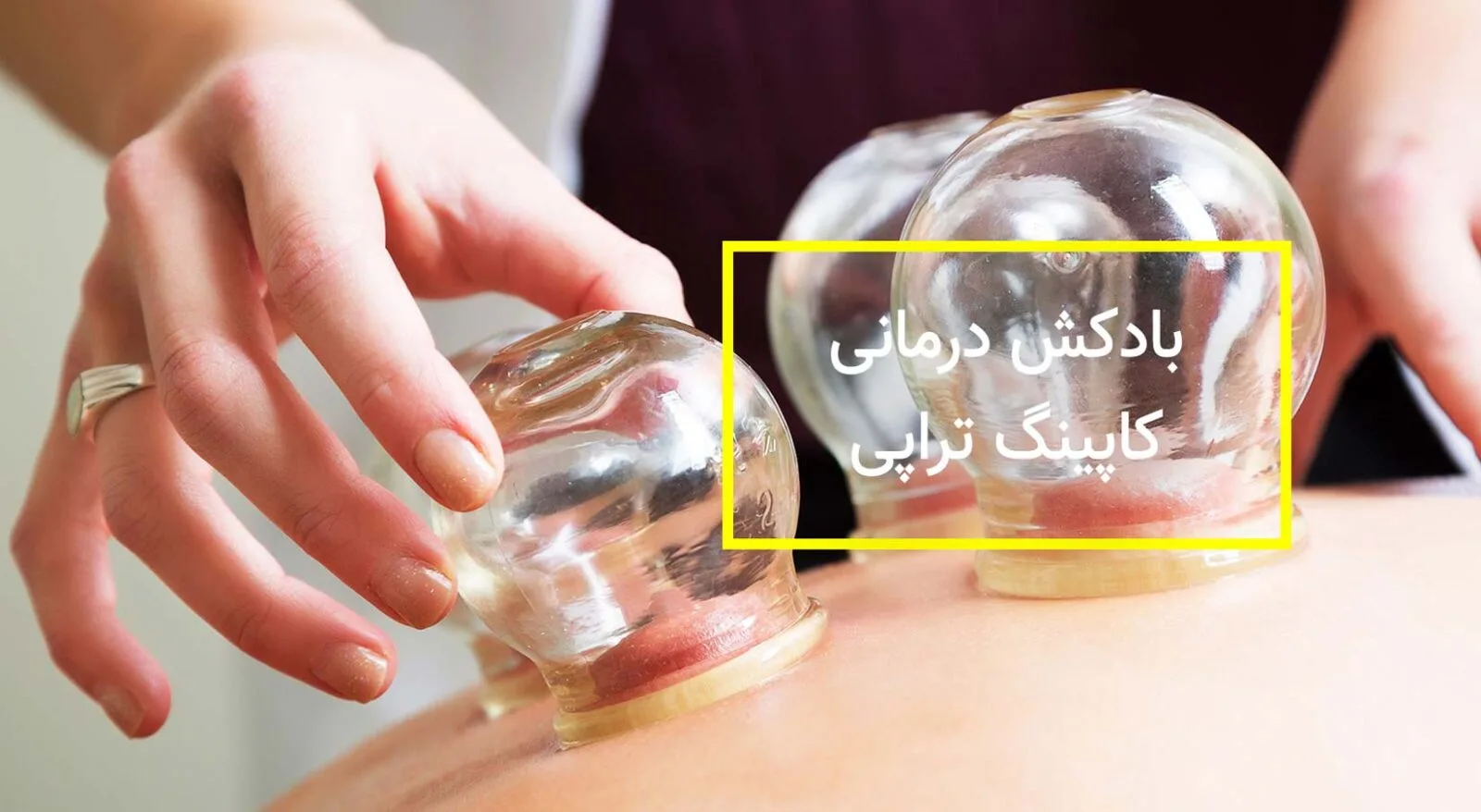 بادکش درمانی