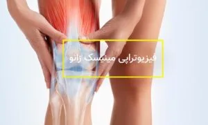 فیزیوتراپی مینیسک زانو