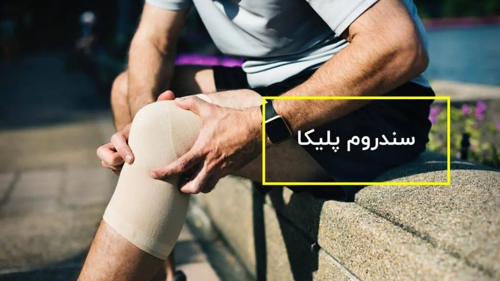 سندروم پلیکا