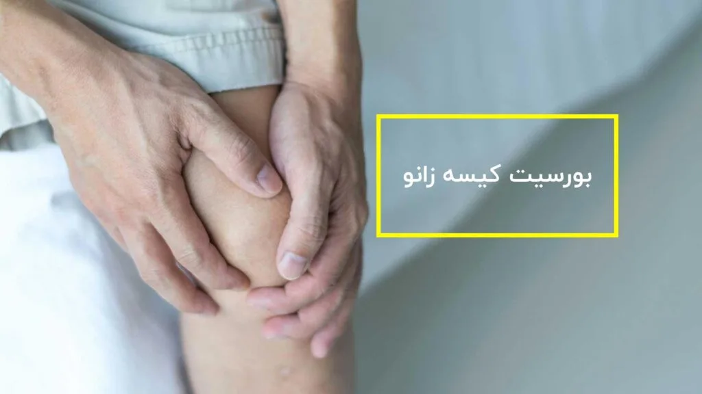 بورسیت زانو