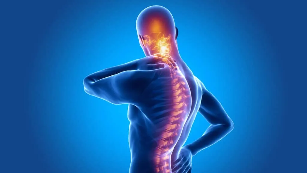 سبک زندگی و اسپوندیلیت آنکیلوزان