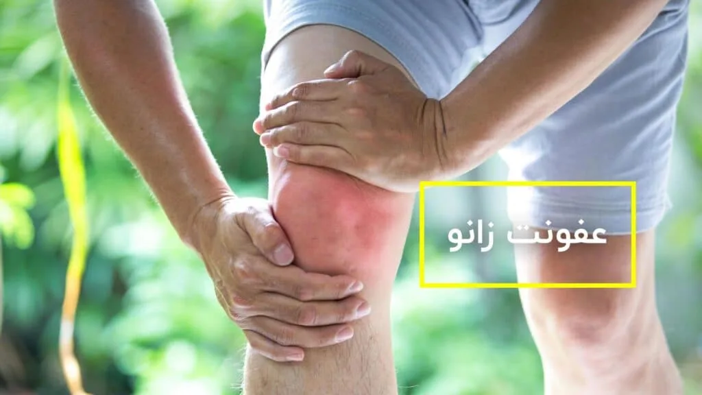 عفونت زانو