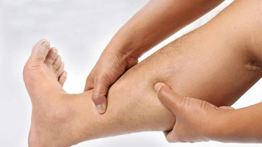 سندروم کمپارتمان