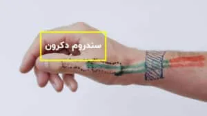 سندروم دکرون