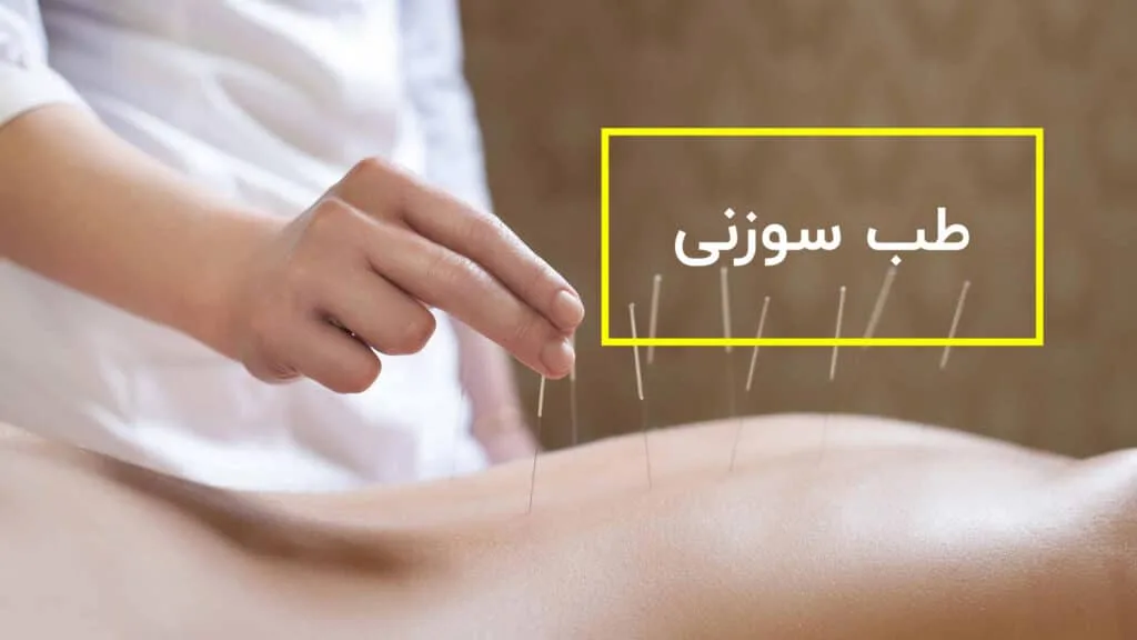 طب سوزنی