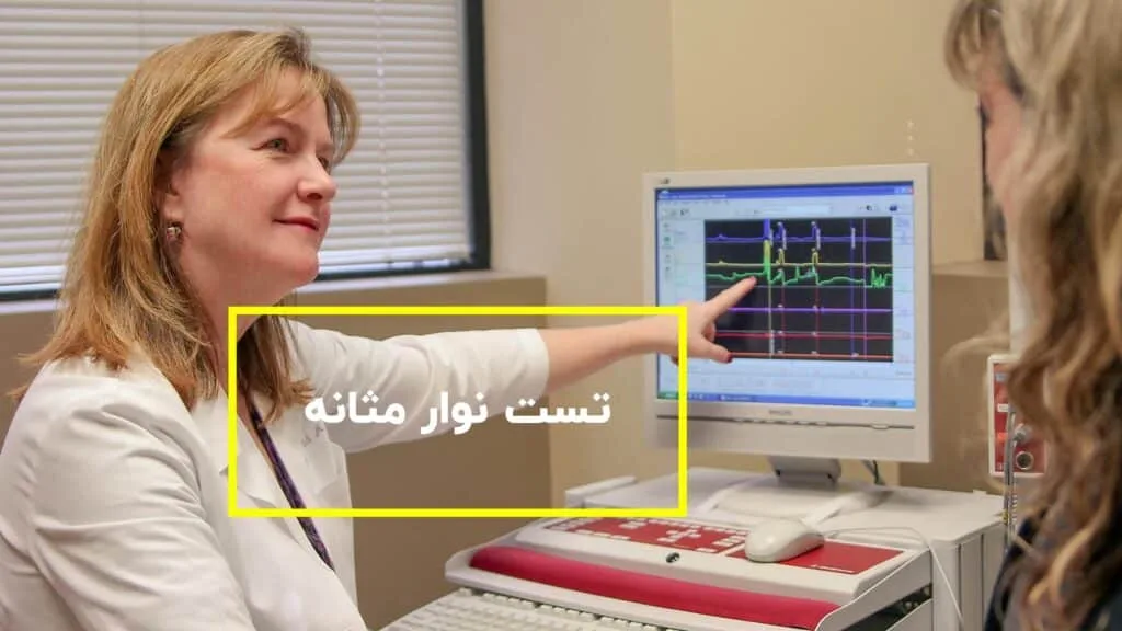 تست نوار مثانه