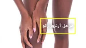 درمان آرتروز زانو
