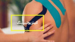 کینزیوتیپینگ