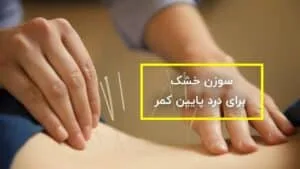 سوزن خشک برای درد پایین کمر