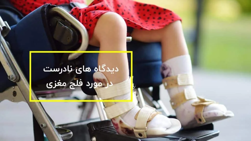 دیدگاه های نادرست در مورد فلج مغزی