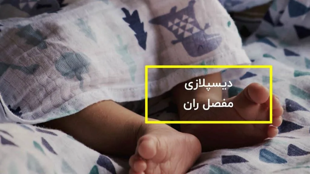 دیسپلازی مفصل ران