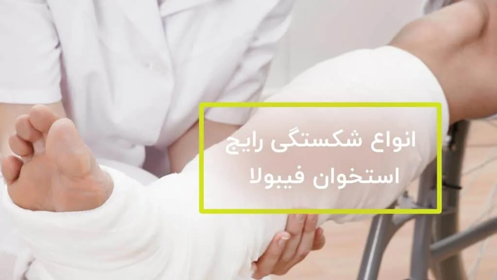 3 نوع شکستگی رایج استخوان فیبولا