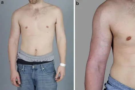 ارزیابی سندرم خروجی قفسه سینه