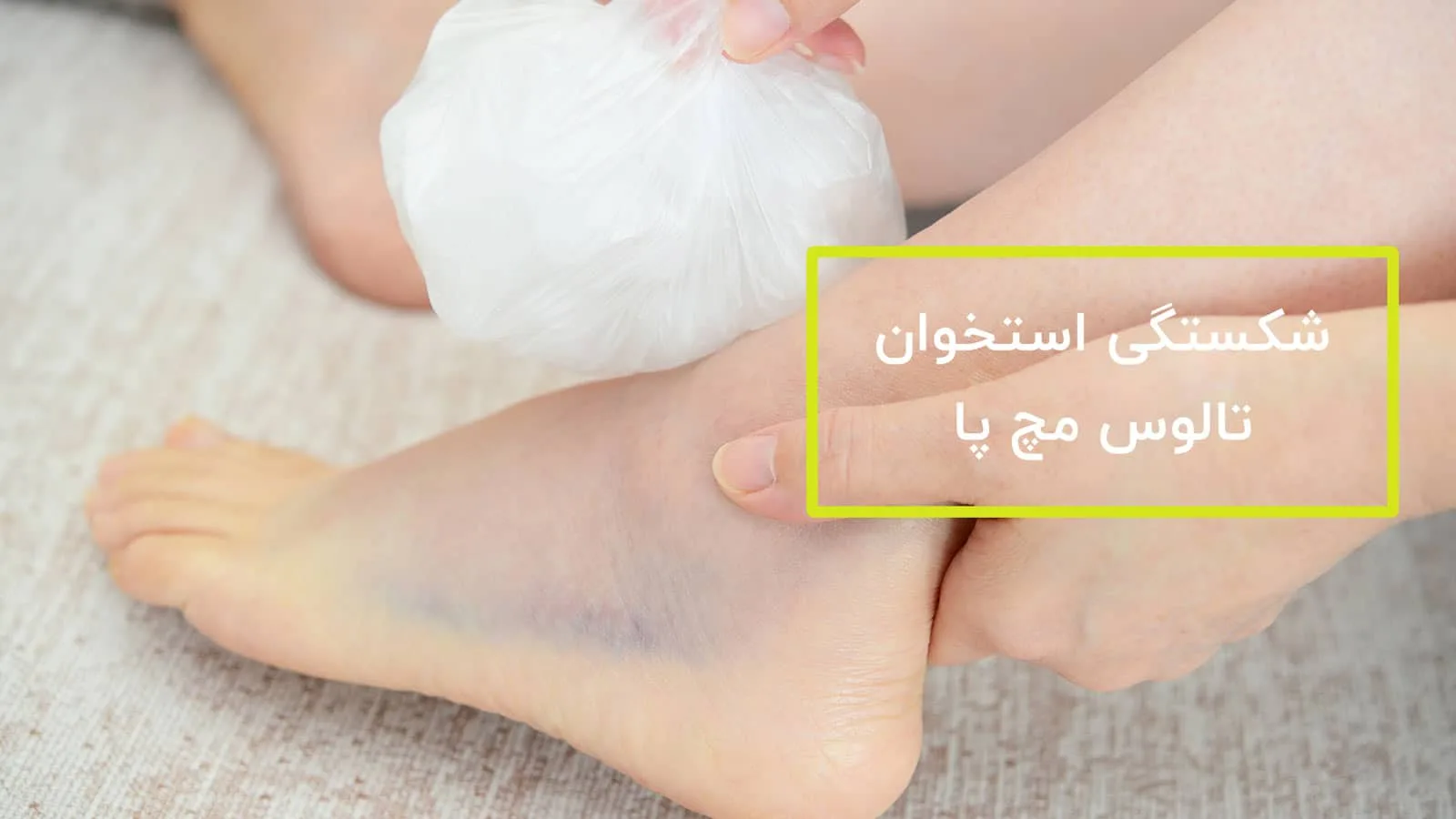 شکستگی استخوان تالوس مچ پا