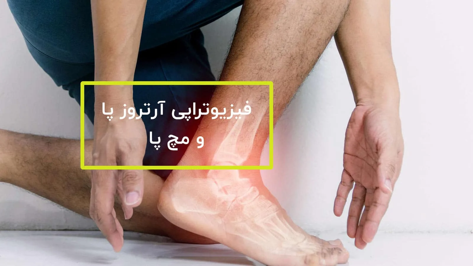 آرتروز مچ پا تشخیص و درمان و فیزیوتراپی