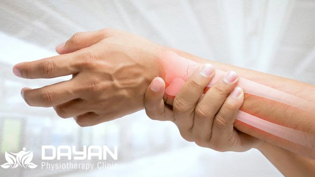 علائم آرتروز مچ دست