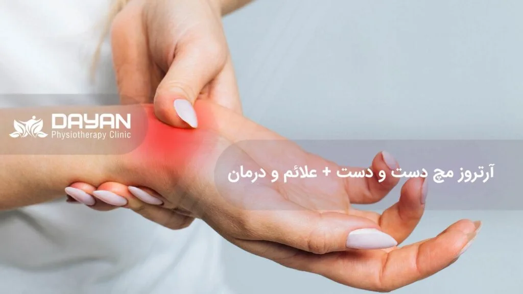 آرتروز مچ دست