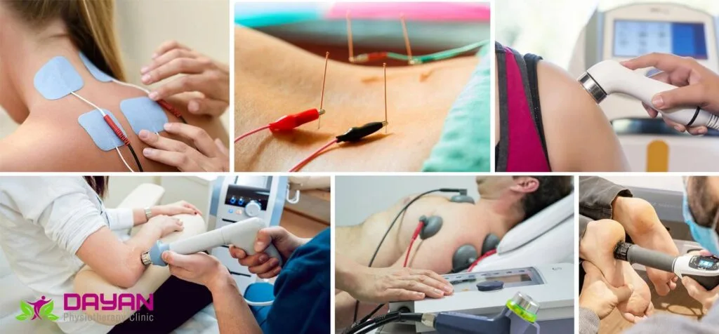 الکتروتراپی فیزیوتراپی