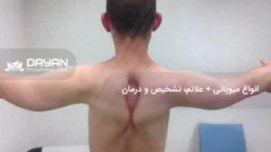 میوپاتی