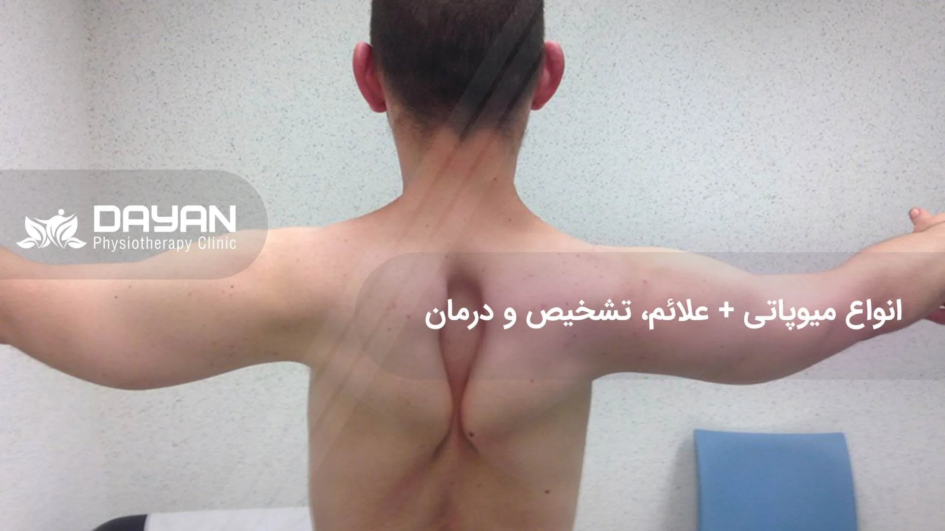 میوپاتی