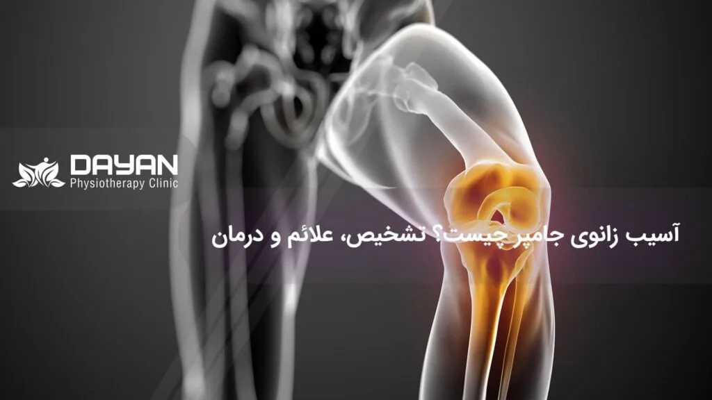 آسیب زانو جامپر