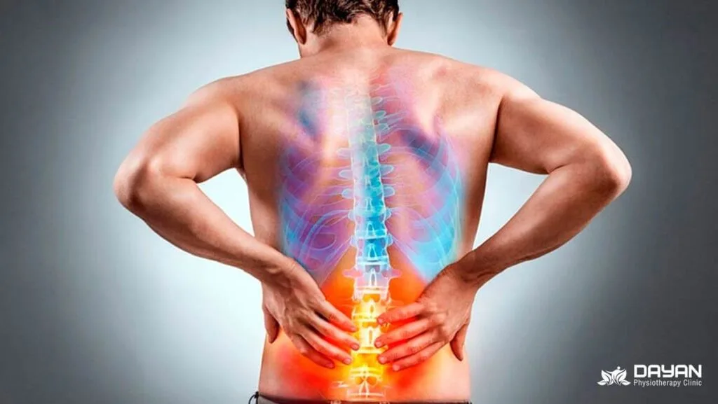 ارتباط کمردرد با عضلات چهارسر