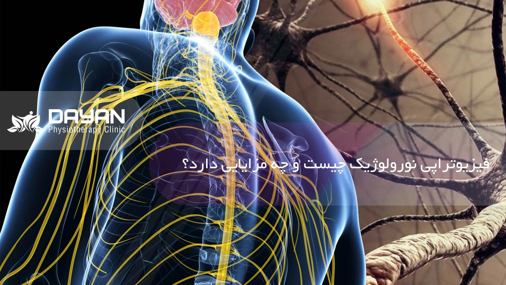 فیزیوتراپی نورولوژیک