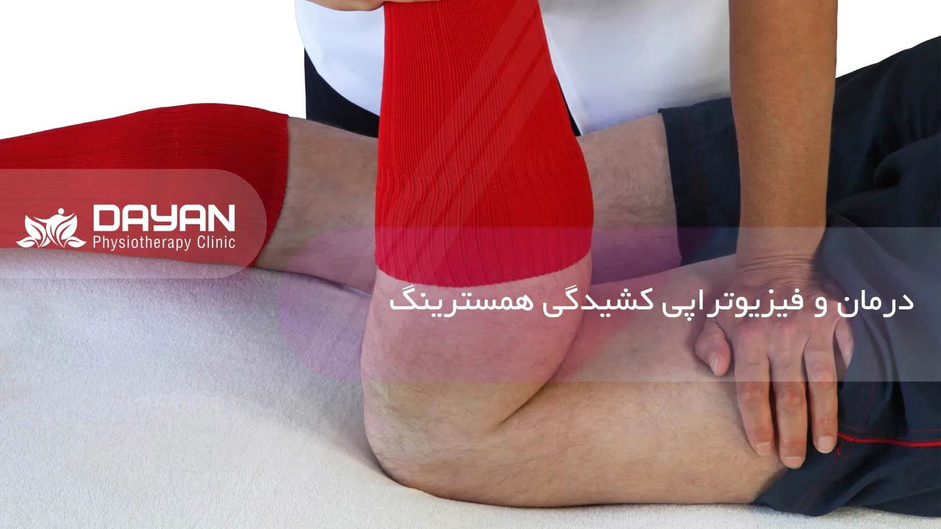 درمان و فیزیوتراپی کشیدگی همسترینگ