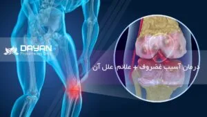 درمان آسیب غضروف