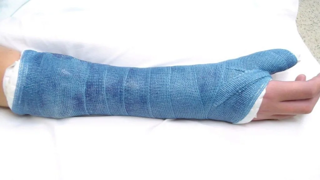 درمان شکستگی انگشت شست دست