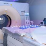 سی تی اسکن (CT Scan) چیست؟ آمادگی و جزئیات کامل