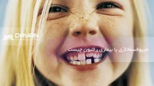 هیپوفسفتازی یا بیماری راثبون چیست