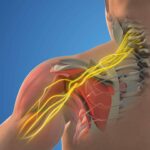 تفاوت درد آرتروز شانه با دیسک گردن و درد عصبی