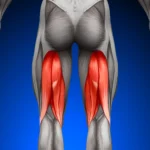 درد پشت ران؛ گرفتگی همسترینگ است یا سیاتیک؟